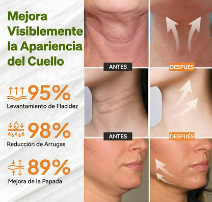 Elixir de Juventud: Crema Reafirmante con Efecto Lifting Inmediato
